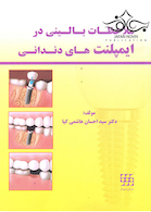 ملاحظات بالینی در ایمپلنت های دندانی