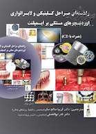 راهنمای مراحل کلینیکی و لابراتواری اوردنچرهای متکی بر ایمپلنت