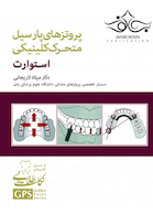 GPS نکات طلایی پروتزهای پارسیل متحرک کلینیکی استوارت