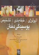 اتیولوژی طبقه بندی تشخیص پوسیدگی دندان