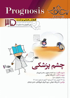 آموزش مبتنی بر تست پروگنوز Prognosis چشم پزشکی