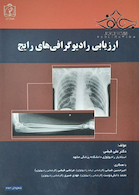 ارزیابی رادیوگرافی های رایج