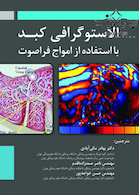 الاستوگرافی کبد با استفاده از امواج فراصوت