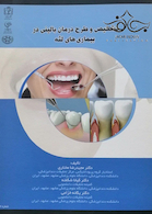 تشخیص و طرح درمان بالینی در بیماری های لثه