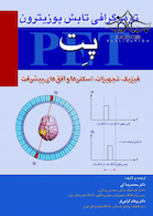 توموگرافی تابش پوزیترون پت