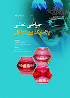 جراحی عملی پلاستیک پریودنتال