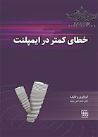 خطای کمتر در ایمپلنت