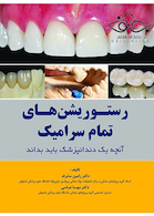 رستوریشن های تمام سرامیک آنچه یه دندانپزشک باید بداند