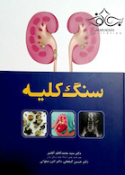 سنگ کلیه