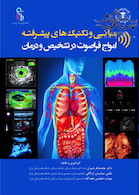 مبانی و تکنیک های پیشرفته امواج فراصوت در تشخیص و درمان