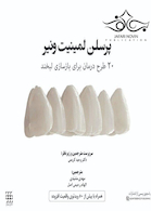 پرسلن لمینیت ونیر