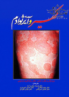 کهیر و آنژیوادم