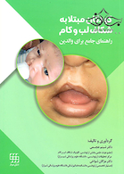 کودکان مبتلا به شکاف لب و کام