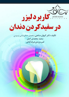 کاربرد لیزر در سفید کردن دندان