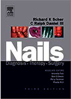 Nails: Diagnosis, Therapy, Surgery 3rd Edition2005 | ناخن ها: تشخیص ، درمان ، جراحی