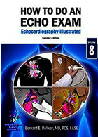 How To Do An Echo Exam: Second Edition (Echocardiography Illustrated) Second Edition | نحوه انجام آزمون اکو: ویرایش دوم