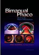 Bimanual Phaco: Mastering the Phakonit/MICS Technique2004
