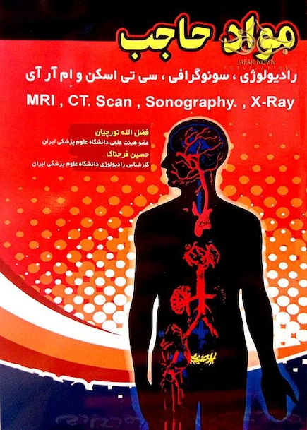 مواد حاجب