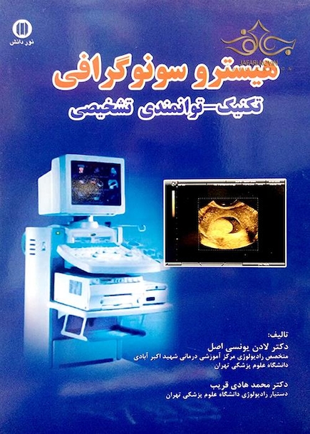 هیسترو سونوگرافی