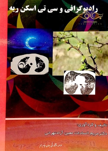 رادیوگرافی و سی تی اسکن ریه