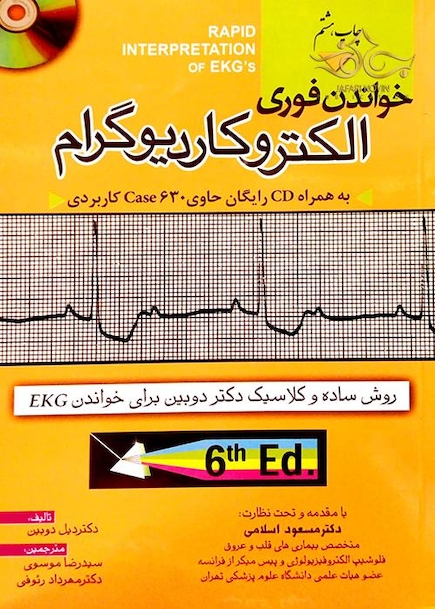 خواندن فوری الکتروکاردیوگرام