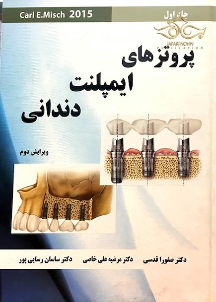 پروتز های ایمپلنت دندانی میش جلد1  Misch 2015