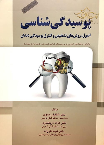 پوسیدگی شناسی  اصول،روش های تشخیص و کنترل پوسیدگی دندان