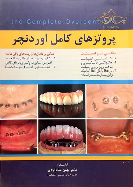 پروتزهای کامل اوردنچر