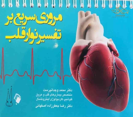 مروری سریع بر تفسیر نوار قلب