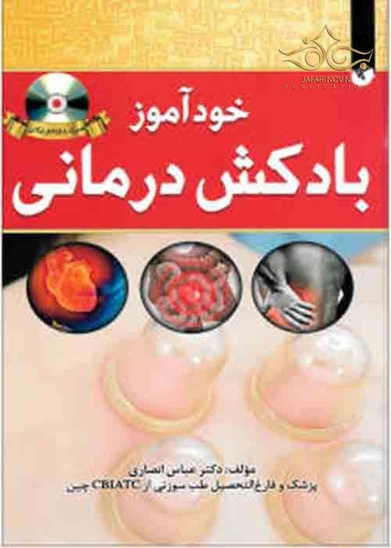 خود آزموز بادکش درمانی