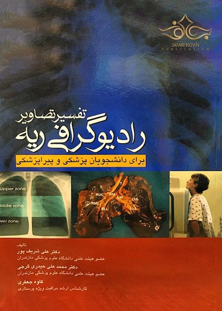 تفسیر تصاویر رادیوگرافی ریه
