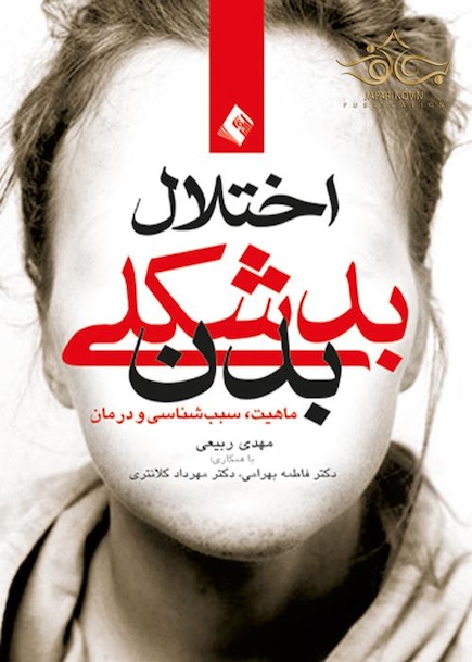 اختلال بدشکلی بدن ماهیت، علل و درمان