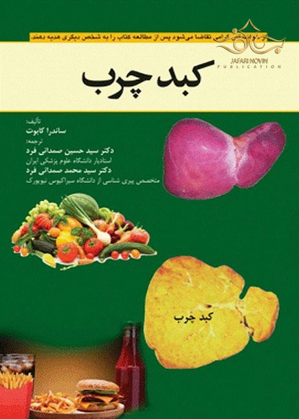 کبد چرب