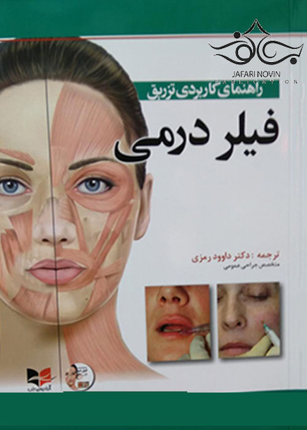 راهنمای کاربردی تزریق فیلر درمی