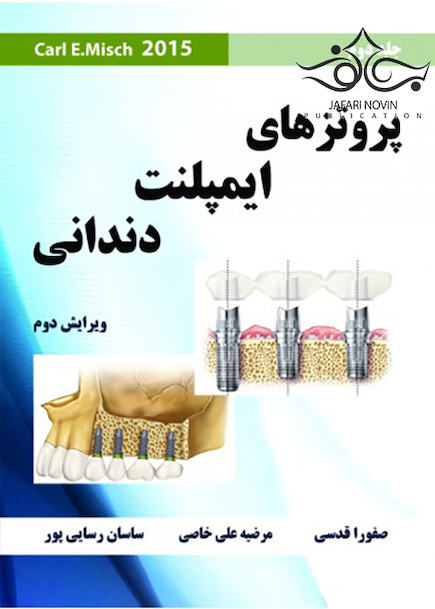 پروتزهای ایمپلنت دندانی میش جلد 2 Misch 2015