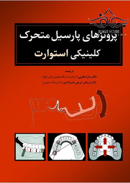 پروتز های پارسیل متحرک کلینیکی استوارت