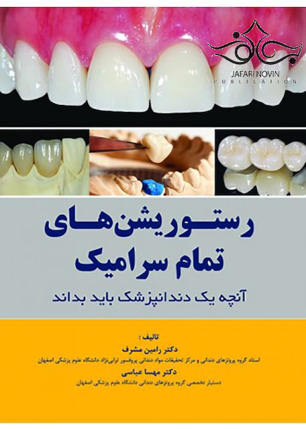 رستوریشن های تمام سرامیک آنچه یه دندانپزشک باید بداند