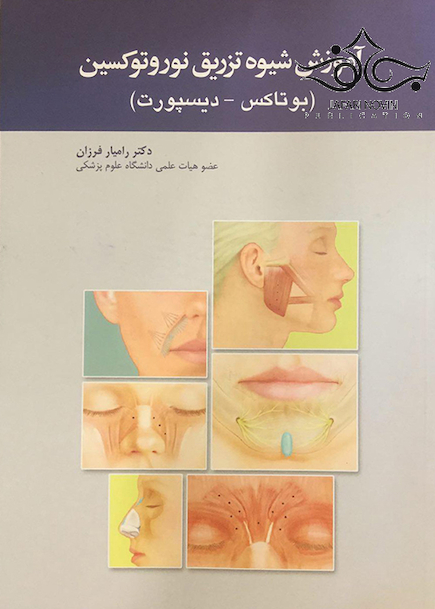 آموزش شیوه تزریق نوروتوکسین (بوتاکس-دیسپورت)