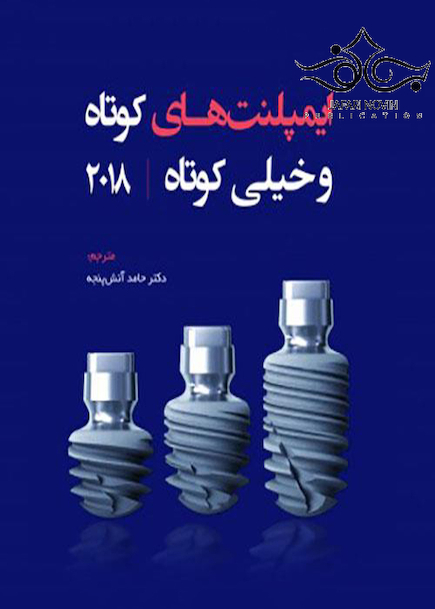ایمپلنت های کوتاه و خیلی کوتاه 2018