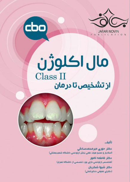 مال اکلوژن Class II؛ از تشخیص تا درمان