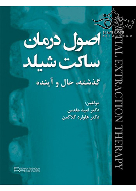 اصول درمان ساکت شیلد گذشته حال و آینده