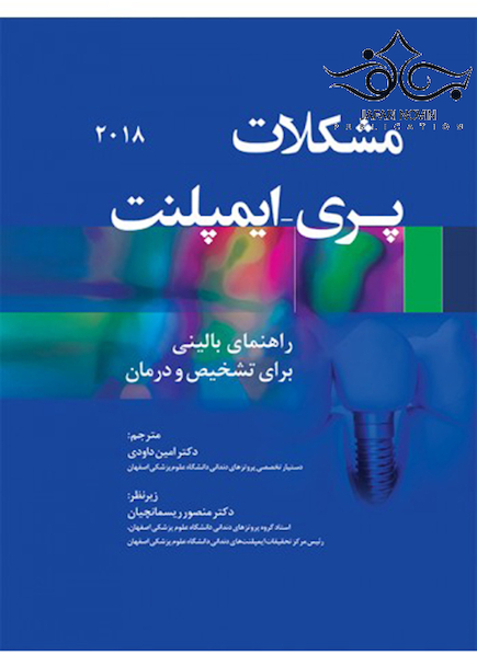 مشکلات پری - ایمپلنت