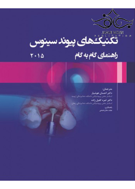 تکنیک های پیوند سینوس راهنمای گام به گام 2015