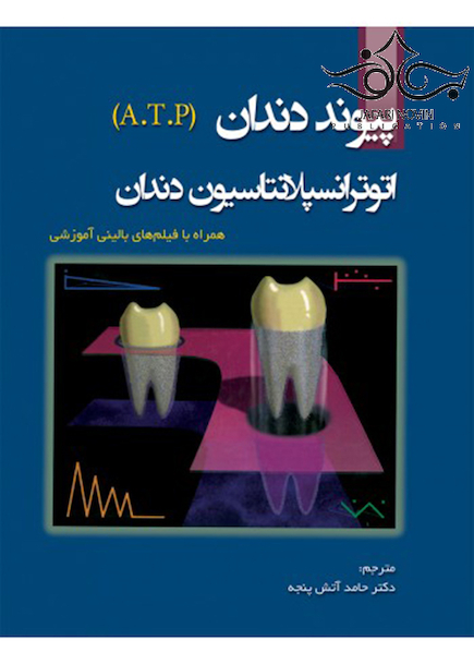 پیوند دندان ATP اتوترانسپلاسیون دندان