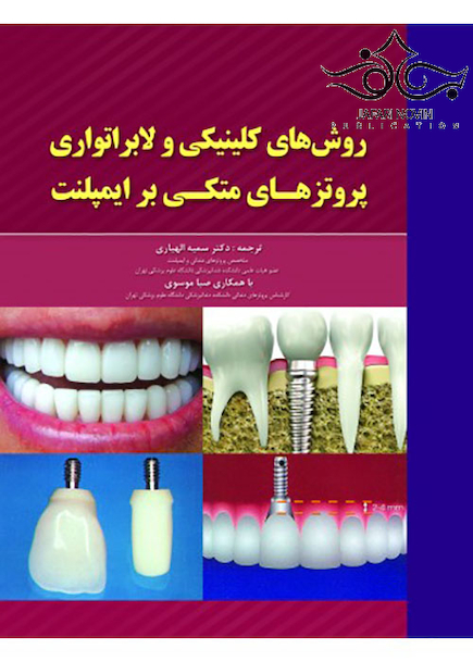 روش های کلینیکی و لابراتواری پروتزهای متکی بر ایمپلنت
