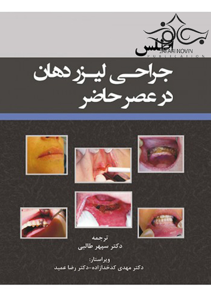 اطلس جراحی لیزر دهان در عصر حاضر