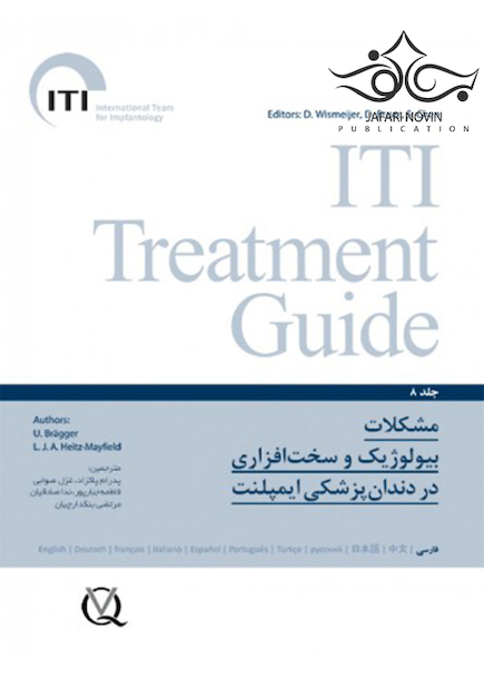 مشکلات بیولوژیک و سخت افزاری در دندانپزشکی ایمپلنت  ITI