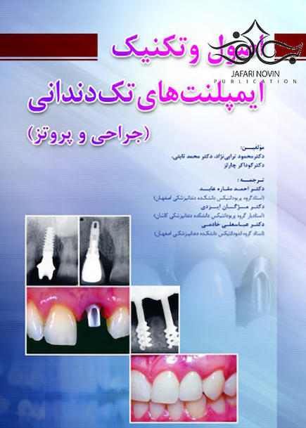 اصول و تکنیک ایمپلنت های تک دندانی جراحی و پروتز