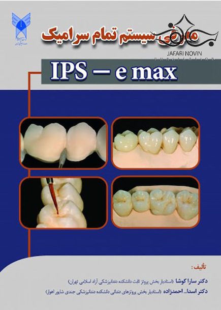 معرفی سیستم تمام سرامیک IPS - e max