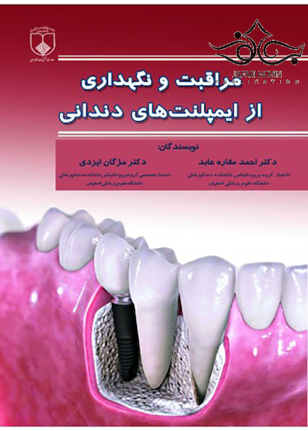 مراقبت و نگهداری از ایمپلنت های دندانی